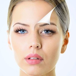 3254 - עולם האסתטיקה הרפואית לא נח לרגע: "אלנסה" - ELLANSE" הטיפול שיעשה פלאות לעור הפנים שלכם.